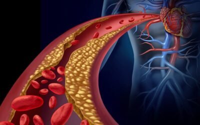 ما هو مرض الكوليسترول؟
