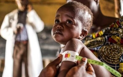 سوء التغذية وأبرز الأمراض الناتجة عنه